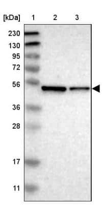 Western Blot: ERGI3 Antibody [NBP1-89882] - Lane 1: Marker  [kDa] 230, 130, 95, 72, 56, 36, 28, 17, 11.  Lane 2: Human cell line RT-4.  Lane 3: Human cell line U-251MG sp