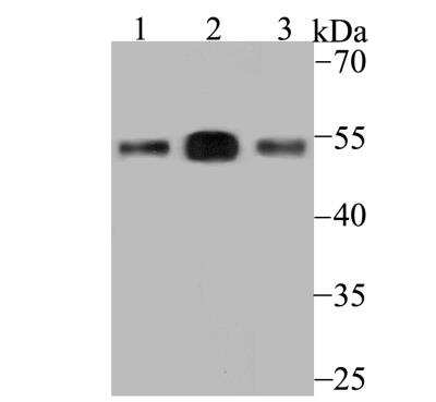 Western Blot: ERGI3 Antibody [NBP2-76928] - Western blot analysis of ERGI3 on different lysates using anti-ERGI3 antibody at 1/500 dilution.Positive control:Lane1: SiHa Lane2: Human placentaLane3: Rat bone marrow