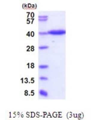 SDS-PAGE Recombinant Human ERGI3 His Protein