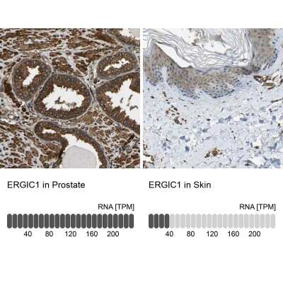 Immunohistochemistry-Paraffin: ERGIC1 Antibody [NBP1-83962] - Staining in human prostate and skin tissues using anti-ERGIC1 antibody. Corresponding ERGIC1 RNA-seq data are presented for the same tissues.