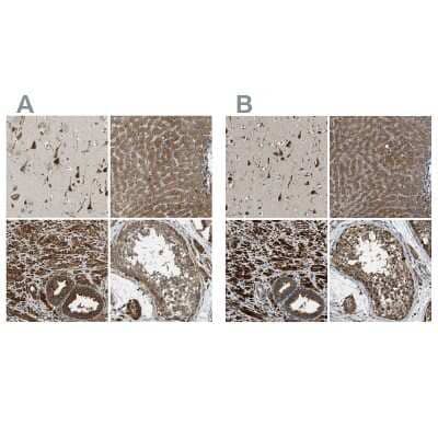 Immunohistochemistry-Paraffin: ERGIC1 Antibody [NBP1-83962] - Staining of human cerebral cortex, liver, prostate and testis using Anti-ERGIC1 antibody NBP1-83962 (A) shows similar protein distribution across tissues to independent antibody NBP1-83963 (B).