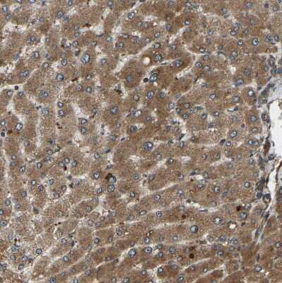 Immunohistochemistry-Paraffin: ERGIC1 Antibody [NBP1-83962] - Staining of human liver shows strong cytoplasmic positivity in hepatocytes.