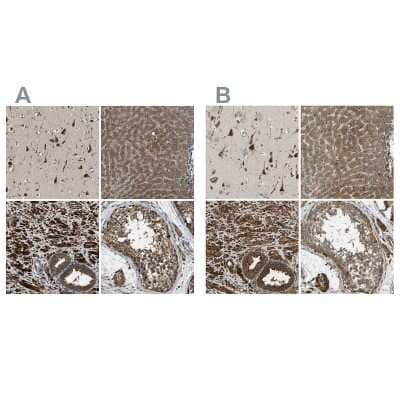 <b>Independent Antibodies Validation. </b>Immunohistochemistry-Paraffin: ERGIC1 Antibody [NBP1-83963] - Staining of human cerebral cortex, liver, prostate and testis using Anti-ERGIC1 antibody NBP1-83963 (A) shows similar protein distribution across tissues to independent antibody NBP1-83962 (B).