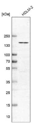 Western Blot: ERGIC1 Antibody [NBP1-83962] - Lane 1: Marker [kDa] 207, 110, 79, 49, 32, 25, 17Lane 2: Human cell line RT-4Lane 3: Human cell line EFO-23