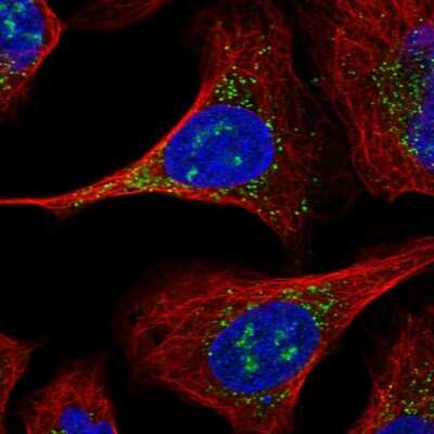 Immunocytochemistry/Immunofluorescence: ERGIC2 Antibody [NBP2-56121] - Staining of human cell line U-2 OS shows localization to nucleoli &amp; vesicles. Antibody staining is shown in green.