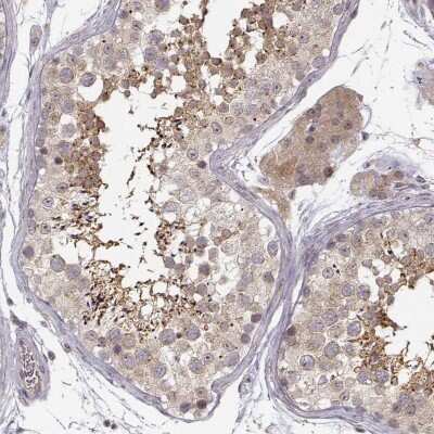 Immunohistochemistry-Paraffin: ERGIC2 Antibody [NBP2-56121] - Immunohistochemical staining of human testis shows strong cytoplasmic positivity in a subset of cells in seminiferous ducts.