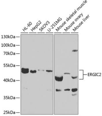 Western Blot: ERGIC2 Antibody [NBP3-05108] - Analysis of extracts of various cell lines, using ERGIC2 antibody at 1:1000 dilution. Secondary antibody: HRP Goat Anti-Rabbit IgG (H+L) at 1:10000 dilution. Lysates/proteins: 25ug per lane. Blocking buffer: 3% nonfat dry milk in TBST. Detection:ECL Basic Kit