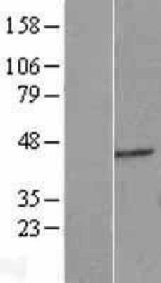 Western Blot: ERGIC2 Overexpression Lysate (Adult Normal) [NBL1-10330] - Western Blot experiments.  Left-Control; Right -Over-expression Lysate for ERGIC2