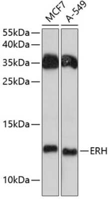 Western Blot: ERH Antibody [NBP3-04401] - Analysis of extracts of various cell lines, using ERH antibody at 1:3000 dilution. Secondary antibody: HRP Goat Anti-Rabbit IgG (H+L) at 1:10000 dilution. Lysates/proteins: 25ug per lane. Blocking buffer: 3% nonfat dry milk in TBST. Detection: ECL Basic Kit