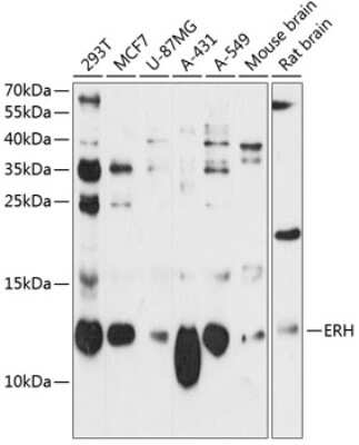 Western Blot: ERH Antibody [NBP3-04402] - Analysis of extracts of various cell lines, using ERH antibody at 1:3000 dilution. Secondary antibody: HRP Goat Anti-Rabbit IgG (H+L) at 1:10000 dilution. Lysates/proteins: 25ug per lane. Blocking buffer: 3% nonfat dry milk in TBST. Detection: ECL Basic Kit