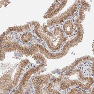 Immunohistochemistry-Paraffin: ERI3 Antibody [NBP1-82099] - Staining of human gall bladder shows moderate cytoplasmic and nuclear positivity in glandular cells.