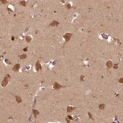 Immunohistochemistry-Paraffin: ERI3 Antibody [NBP2-48591] - Staining of human lateral ventricle shows strong cytoplasmic and nuclear positivity in neuronal cells.