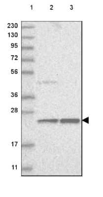 Western Blot: ERI3 Antibody [NBP2-48591] - Lane 1: Marker [kDa] 230, 130, 95, 72, 56, 36, 28, 17, 11Lane 2: Human cell line RT-4Lane 3: Human cell line U-251 MG