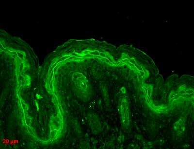 Immunocytochemistry/Immunofluorescence: ERK1/2 Antibody [NBP2-12728] - Tissue: backskin. Species: Mouse. ERK1 Polyclonal Antibody at 1:100 for 1 hour at RT. Secondary Antibody: FITC Goat Anti-Rabbit (green) at 1:50 for 1 hour at RT. Localization: Cytoplasm. This image is courtesy of Dr. Turksen, Ottawa Hospital Research Institute, Canada.