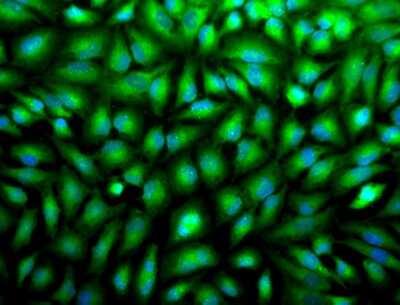 Immunocytochemistry/Immunofluorescence: ERK1/2 Antibody [NBP2-12728] - Tissue: HeLa Cells. Species: Human. Fixation: 2% Formaldehyde for 20 min at RT. Primary Antibody: Rabbit Anti-Erk1/2 Polyclonal Antibody at 1:100 for 12 hours at 4C. Secondary Antibody: APC Goat Anti-Rabbit (red) at 1:200 for 2 hours at RT. Counterstain: DAPI (blue) nuclear stain at 1:40000 for 2 hours at RT. Localization: Cytoplasm. Nucleus. Magnification: 100x.