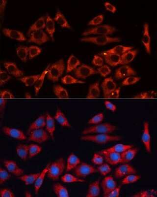 Immunocytochemistry/Immunofluorescence: ERK1/2 Antibody [NBP3-05645] - Immunofluorescence analysis of NIH-3T3 cells using ERK1/2 Polyclonal Antibody (NBP3-05645) at dilution of 1:100 (40x lens). Blue: DAPI for nuclear staining.