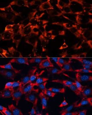 Immunocytochemistry/Immunofluorescence: ERK1/2 Antibody [NBP3-05645] - Confocal immunofluorescence analysis of Hela cells using ERK1/2 Polyclonal Antibody (NBP3-05645) at dilution of 1:200. Blue: DAPI for nuclear staining.