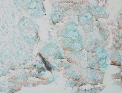 Immunohistochemistry-Paraffin: ERK1/2 Antibody [NBP2-12728] - Tissue: Inflamed colon. Species: Mouse. Fixation: Formalin. Primary Antibody: Rabbit Anti-ERK1 Polyclonal Antibody at 1:25000 for 12 hours at 4-C. Secondary Antibody: Biotin Goat Anti-Rabbit at 1:2000 for 1 hour at RT. Counterstain: Methyl Green at 200 uL for 2 min at RT