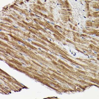 Immunohistochemistry-Paraffin: ERK1/2 Antibody [NBP3-05652] - Mouse heart using ERK1/2 Rabbit pAb (NBP3-05652) at dilution of 1:200 (40x lens).