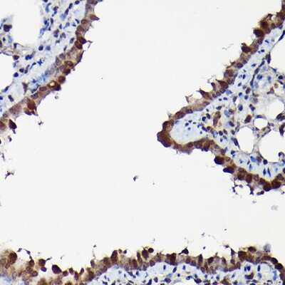 Immunohistochemistry-Paraffin: ERK1/2 Antibody [NBP3-05652] - Rat lung using ERK1/2 Rabbit pAb (NBP3-05652) at dilution of 1:200 (40x lens).