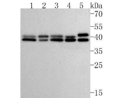 Western Blot: ERK1/2 Antibody (SA43-03) [NBP2-67303] - Western blot analysis of ERK1/2 on different lysates. Proteins were transferred to a PVDF membrane and blocked with 5% BSA in PBS for 1 hour at room temperature. The primary antibody (1/500) was used in 5% BSA at room temperature for 2 hours. Goat Anti-Rabbit IgG - HRP Secondary Antibody (HA1001) at 1:5,000 dilution was used for 1 hour at room temperature.Positive control: Lane 1: Hela cell lysate Lane 2: SW480 cell lysate Lane 3: HCT116 cell lysate Lane 4: PC-12 cell lysate