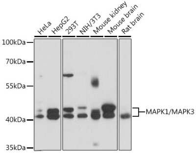 Western Blot: ERK1/2 Antibody [NBP3-05645] - Western blot analysis of extracts of various cell lines, using ERK1/2 antibody (NBP3-05645) at 1:1000 dilution. Secondary antibody: HRP Goat Anti-Rabbit IgG (H+L) at 1:10000 dilution. Lysates/proteins: 25ug per lane. Blocking buffer: 3% nonfat dry milk in TBST. Detection: ECL Basic Kit. Exposure time: 10s.