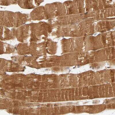 Immunohistochemistry-Paraffin: ERK1 Antibody [NBP1-84808] - Staining of human skeletal muscle shows strong cytoplasmic positivity in myocytes.