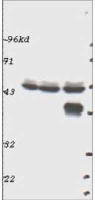 Western Blot: ERK1 Antibody [NBP1-78031] - Detection of ERK1 in whole cell lysates prepared from mouse brain (left), mouse kidney (center) and mouse intestine (right).