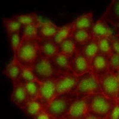 Immunocytochemistry/Immunofluorescence: ERK2 Antibody (1A4) [NBP1-74025] - Human MCF7 cells stained with Phalloidin-TRITC (Red) for Actin staining and monoclonal anti-human MAPK1 antibody (1:500) with Alexa 488 (Green).