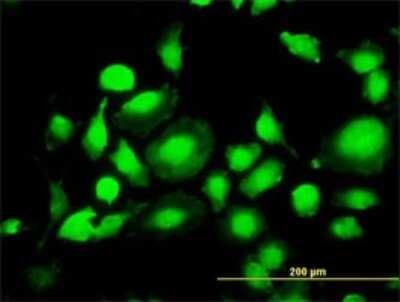 Immunocytochemistry/Immunofluorescence: ERK2 Antibody (1D1) [H00005594-M01] - Analysis of monoclonal antibody to MAPK1 on HeLa cell. Antibody concentration 10 ug/ml.