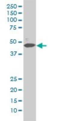 Western Blot: ERK2 Antibody (1D1) [H00005594-M01] - MAPK1 monoclonal antibody (M01), clone 1D1 Analysis of MAPK1 expression in Hela S3 NE.