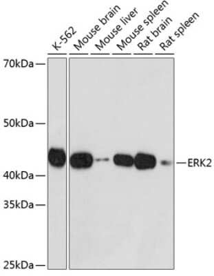 Western Blot: ERK2 Antibody (7I5L7) [NBP3-15826] - Western blot analysis of extracts of various cell lines, using ERK2 antibody (NBP3-15826) at 1:1000 dilution. Secondary antibody: HRP Goat Anti-Rabbit IgG (H+L) at 1:10000 dilution. Lysates/proteins: 25ug per lane. Blocking buffer: 3% nonfat dry milk in TBST. Detection: ECL Basic Kit. Exposure time: 1s.