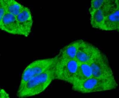 Immunocytochemistry/Immunofluorescence: ERK2 Antibody (SZ25-01) [NBP2-67360] - Staining ERK2 in Hela cells (green). The nuclear counter stain is DAPI (blue). Cells were fixed in paraformaldehyde, permeabilised with 0.25% Triton X100/PBS.