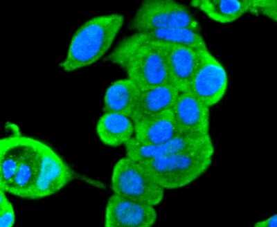 Immunocytochemistry/Immunofluorescence: ERK2 Antibody (SZ25-01) [NBP2-67360] - Staining ERK2 in MCF-7 cells (green). The nuclear counter stain is DAPI (blue). Cells were fixed in paraformaldehyde, permeabilised with 0.25% Triton X100/PBS.