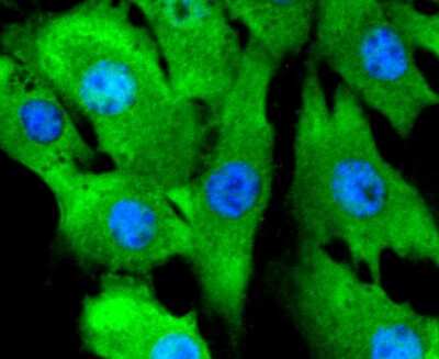 Immunocytochemistry/Immunofluorescence: ERK2 Antibody (SZ25-01) [NBP2-67360] - Staining ERK2 in NIH/3T3 cells (green). The nuclear counter stain is DAPI (blue). Cells were fixed in paraformaldehyde, permeabilised with 0.25% Triton X100/PBS.