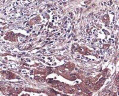 Immunohistochemistry-Paraffin: ERK2 Antibody (SZ25-01) [NBP2-67360] - Analysis of paraffin-embedded mouse intestine tissue using anti-ERK2 antibody. Image from verified customer review.