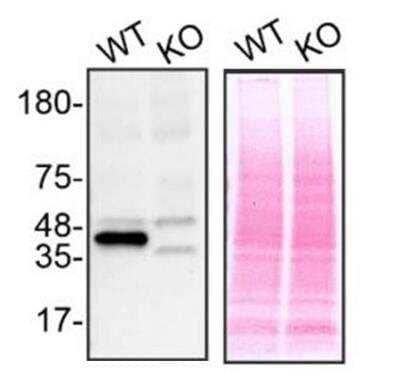 Knockout Validated: ERK2 Antibody (SZ25-01) [NBP2-67360] - Lysates of HeLa WT and MAPK1 KO were prepared, and 30 ug of protein were processed for immunoblot with the indicated Mitogen-activated protein kinase 1 antibodies. The Ponceau stained transfers of each blot are shown. Antibody dilution used: 1/1000. Predicted band size: 41 kDa. Image, protocol and testing courtesy of YCharOS Inc. (ycharos.com).