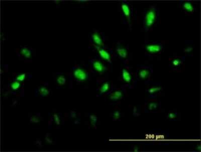 Immunocytochemistry/Immunofluorescence: ERK3/MAPK6 Antibody (4C11) [H00005597-M02] - Analysis of monoclonal antibody to MAPK6 on HeLa cell. Antibody concentration 10 ug/ml.