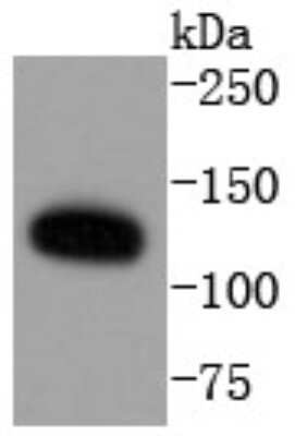 Western Blot: ERK5/BMK1 Antibody (SD2084) [NBP2-67802] - Analysis of ERK5 on Hela cells lysates using anti-ERK5 antibody at 1/1,000 dilution.