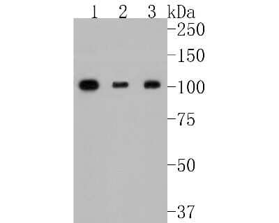 Western Blot: ERK5/BMK1 Antibody (SD2084) [NBP2-67802] - Western blot analysis of ERK5/BMK1 on different lysates. Proteins were transferred to a PVDF membrane and blocked with 5% BSA in PBS for 1 hour at room temperature. The primary antibody (1/500) was used in 5% BSA at room temperature for 2 hours. Goat Anti