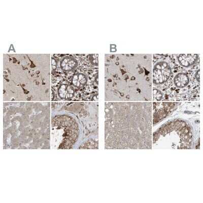 Immunohistochemistry-Paraffin ERLEC1 Antibody