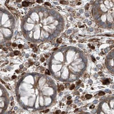 Immunohistochemistry-Paraffin: ERLEC1 Antibody [NBP1-86802] - Staining of human colon.