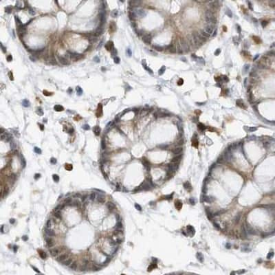 Immunohistochemistry-Paraffin: ERLEC1 Antibody [NBP1-86803] - Staining of human colon.