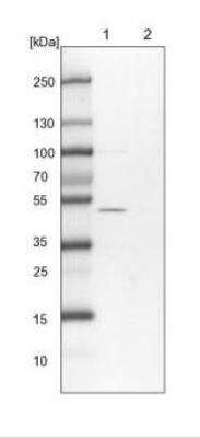 Western Blot: ERLEC1 Antibody [NBP1-86802] - Lane 1: NIH-3T3 cell lysate (Mouse embryonic fibroblast cells). Lane 2: NBT-II cell lysate (Rat Wistar bladder tumor cells).