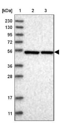 <b>Independent Antibodies Validation. </b>Western Blot: ERLEC1 Antibody [NBP1-86802] - Lane 1: Marker  [kDa] 230, 130, 95, 72, 56, 36, 28, 17, 11.  Lane 2: Human cell line RT-4.  Lane 3: Human cell line U-251MG sp