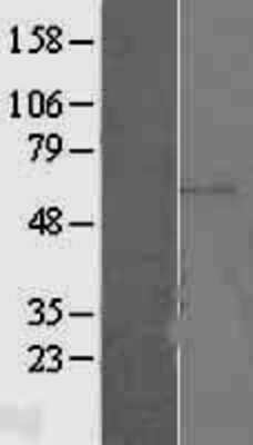 Western Blot: ERM/Etv5 Overexpression Lysate (Adult Normal) [NBL1-10361] Left-Empty vector transfected control cell lysate (HEK293 cell lysate); Right -Over-expression Lysate for ERM/Etv5.