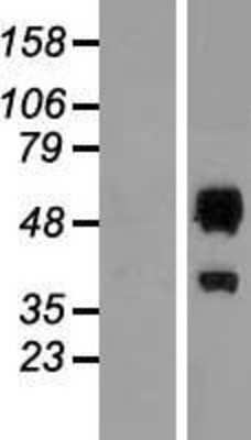 Western Blot: ERMAP Overexpression Lysate (Adult Normal) [NBP2-06789] Left-Empty vector transfected control cell lysate (HEK293 cell lysate); Right -Over-expression Lysate for ERMAP.