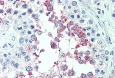 Immunohistochemistry-Paraffin ERMP1 Antibody - BSA Free