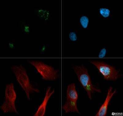 Immunocytochemistry/Immunofluorescence: ERManI Antibody (3C2) [NBP2-13167] - ERManI antibody was tested in HeLa cells with DyLight 488 (green). Nuclei and alpha-tubulin were counterstained with DAPI (blue) and Dylight 550 (red).