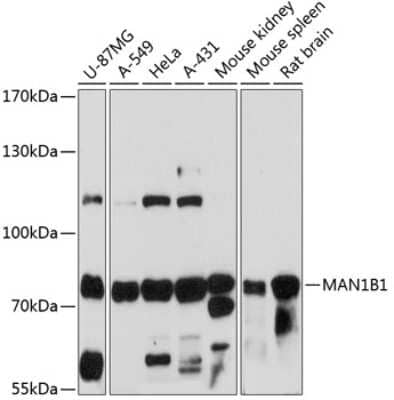 Western Blot: ERManI Antibody [NBP3-03426] - Analysis of extracts of various cell lines, using ERManI antibody at 1:3000 dilution. Secondary antibody: HRP Goat Anti-Rabbit IgG (H+L) at 1:10000 dilution. Lysates/proteins: 25ug per lane. Blocking buffer: 3% nonfat dry milk in TBST. Detection: ECL Basic Kit.